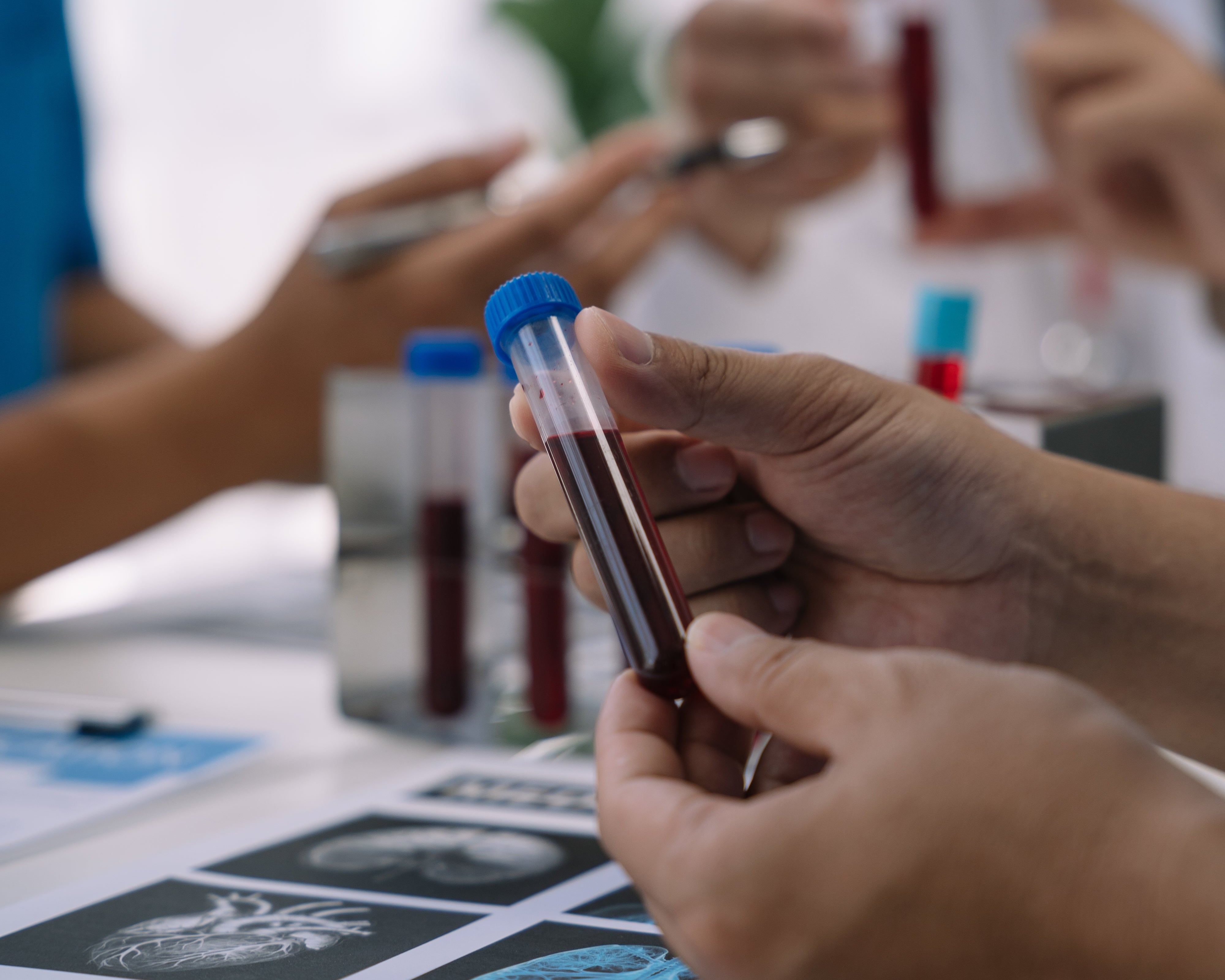 Guida all'interpretazione degli esami del sangue della tiroide