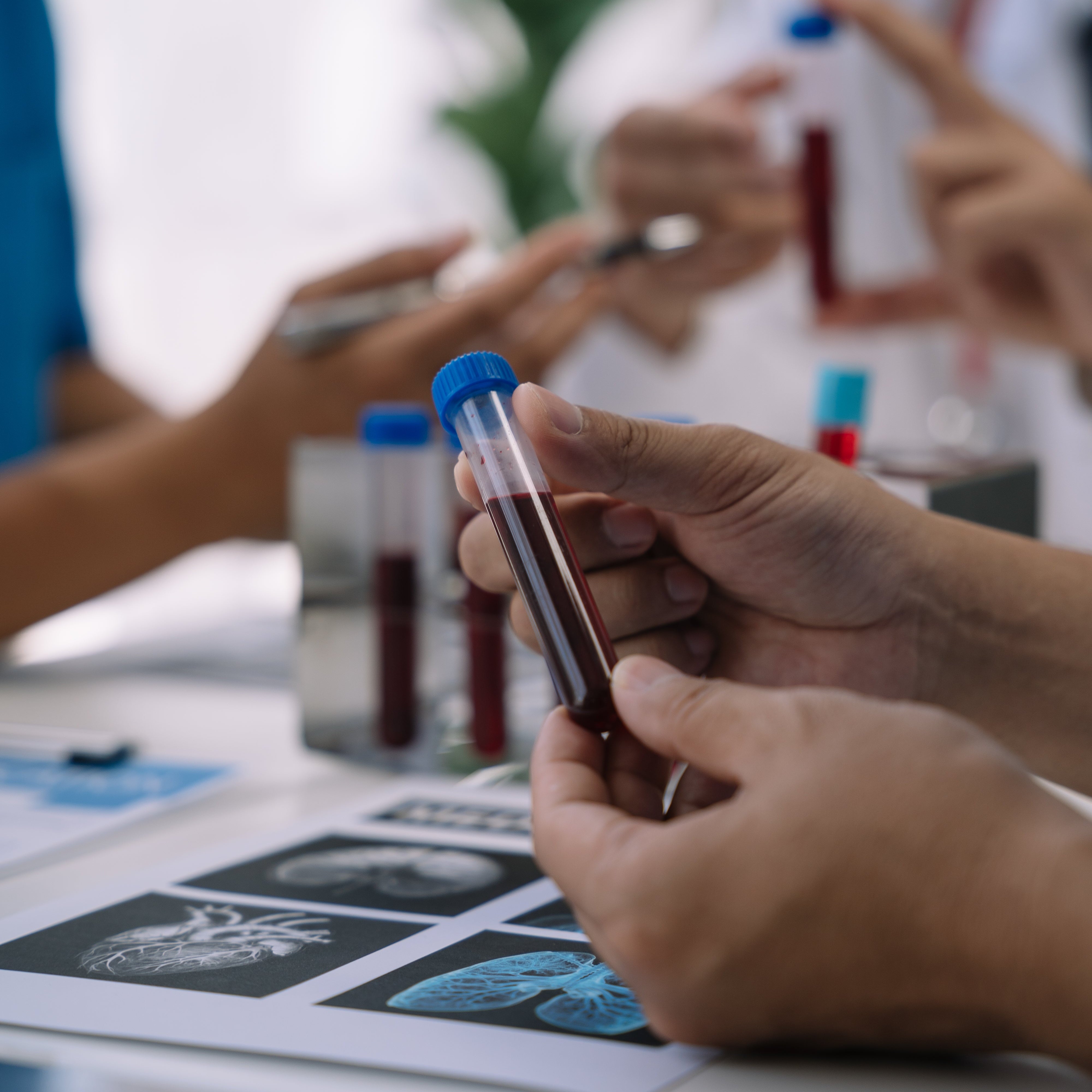 Guida all'interpretazione degli esami del sangue della tiroide